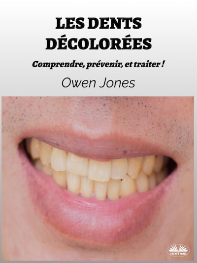 Les Dents Décolorées